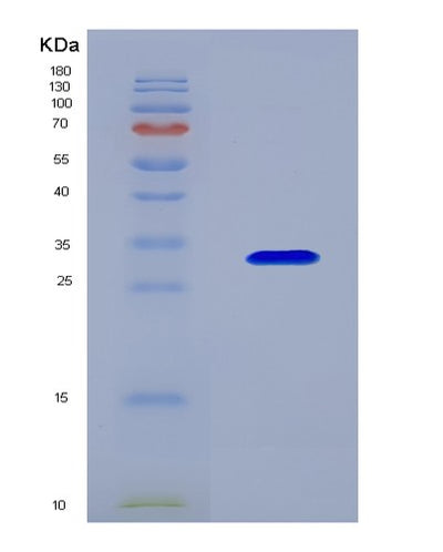 SDS-PAGE analysis of Human COL4A1 (Collagen Alpha-1(Iv) Chain) - Recombinant Protein, CAT# BLT-08361P, showing >90% purity under 15% SDS-PAGE (Reduced)Human COL4A1 (Collagen Alpha-1(Iv) Chain) - Recombinant Protein