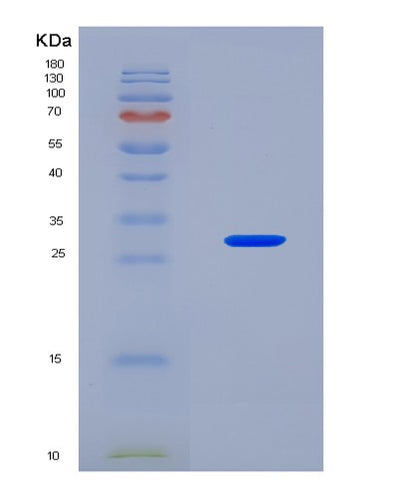 SDS-PAGE analysis of Human COL4A2 (Collagen Alpha-2(Iv) Chain) - Recombinant Protein, CAT# BLT-08362P, showing >90% purity under 15% SDS-PAGE (Reduced)Human COL4A2 (Collagen Alpha-2(Iv) Chain) - Recombinant Protein