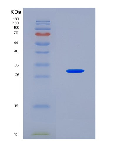 SDS-PAGE analysis of Human COL4A2 (Collagen Alpha-2(Iv) Chain) - Recombinant Protein, CATHuman COL4A2 (Collagen Alpha-2(Iv) Chain) - Recombinant Protein