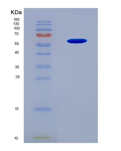 SDS-PAGE analysis of Human (Immunoglobulin Mu Heavy Chain) - Recombinant Protein, CAT# BLT-08363P, showing >90% purity under 15% SDS-PAGE (Reduced)Human (Immunoglobulin Mu Heavy Chain) - Recombinant Protein