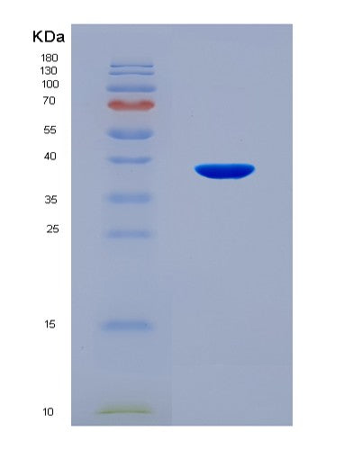 SDS-PAGE analysis of Human HSD11B2 (11-Beta-Hydroxysteroid Dehydrogenase Type 2) - Recombinant Protein, CATHuman HSD11B2 (11-Beta-Hydroxysteroid Dehydrogenase Type 2) - Recombinant Protein
