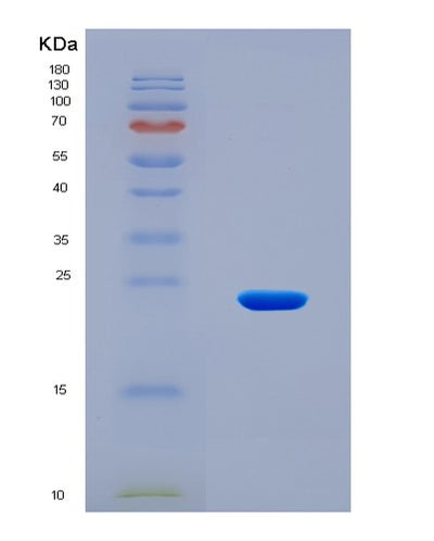 SDS-PAGE analysis of Human BCL2L15 (Bcl-2-Like Protein 15) - Recombinant Protein, CAT# BLT-08365P, showing >90% purity under 15% SDS-PAGE (Reduced)Human BCL2L15 (Bcl-2-Like Protein 15) - Recombinant Protein