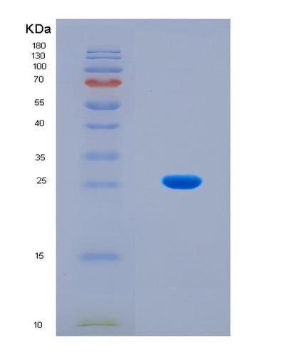 SDS-PAGE analysis of Human IFNA1 (Interferon Alpha-1/13) - Recombinant Protein, CAT# BLT-08473P showing >90% purity under 15% SDS-PAGE (Reduced)Human IFNA1 (Interferon Alpha-1/13) - Recombinant Protein