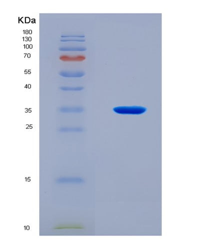 SDS-PAGE analysis of Human NEIL1 (Endonuclease 8-Like 1) - Recombinant Protein, CAT# BLT-08476P showing >90% purity under 15% SDS-PAGE (Reduced)Human NEIL1 (Endonuclease 8-Like 1) - Recombinant Protein