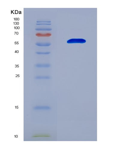 SDS-PAGE analysis of Mouse Il4i1 (L-Amino-Acid Oxidase) - Recombinant Protein, CAT# BLT-08477P showing >90% purity under 15% SDS-PAGE (Reduced)Mouse Il4i1 (L-Amino-Acid Oxidase) - Recombinant Protein