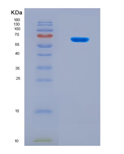 SDS-PAGE analysis of Mouse Lars1 (Leucine--Trna Ligase, Cytoplasmic) - Recombinant Protein, CAT# BLT-08479P showing >90% purity under 15% SDS-PAGE (Reduced)Mouse Lars1 (Leucine--Trna Ligase, Cytoplasmic) - Recombinant Protein