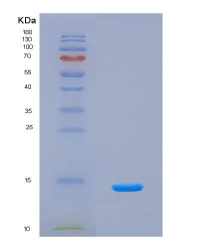 SDS-PAGE analysis of Human AGER (Advanced Glycosylation End Product-Specific Receptor) - Recombinant Protein, CATHuman AGER (Advanced Glycosylation End Product-Specific Receptor) - Recombinant Protein
