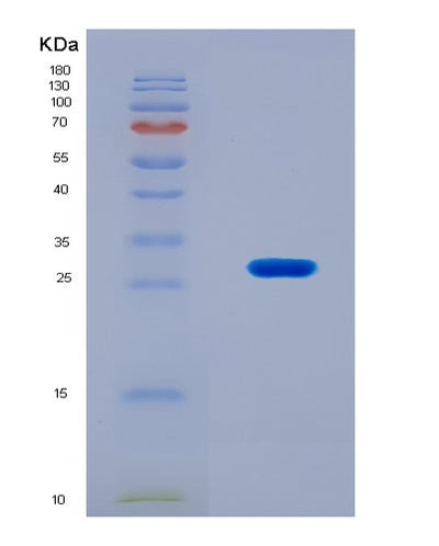 SDS-PAGE analysis of Human DKK4 (Dickkopf-Related Protein 4) - Recombinant Protein, CAT# BLT-08481P showing >90% purity under 15% SDS-PAGE (Reduced)Human DKK4 (Dickkopf-Related Protein 4) - Recombinant Protein
