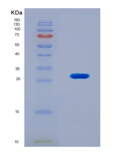 SDS-PAGE analysis of Human DKK4 (Dickkopf-Related Protein 4) - Recombinant Protein, CATHuman DKK4 (Dickkopf-Related Protein 4) - Recombinant Protein