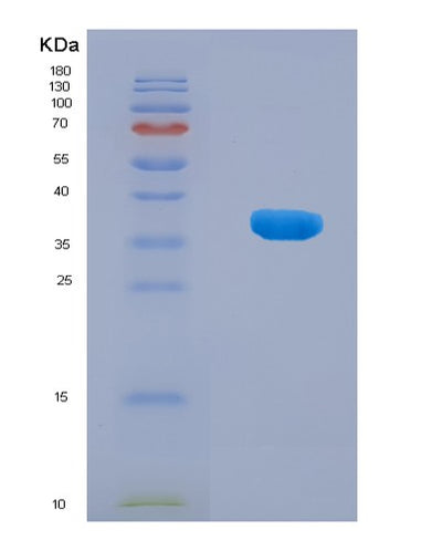 SDS-PAGE analysis of Human G3BP1 (Ras Gtpase-Activating Protein-Binding Protein 1) - Recombinant Protein, CAT# BLT-08482P showing >90% purity under 15% SDS-PAGE (Reduced)Human G3BP1 (Ras Gtpase-Activating Protein-Binding Protein 1) - Recombinant Protein
