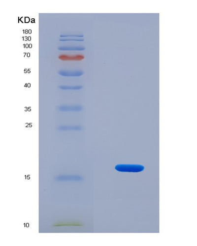 SDS-PAGE analysis of Human SNRPE (Small Nuclear Ribonucleoprotein E) - Recombinant Protein, CAT# BLT-08486P showing >90% purity under 15% SDS-PAGE (Reduced)Human SNRPE (Small Nuclear Ribonucleoprotein E) - Recombinant Protein