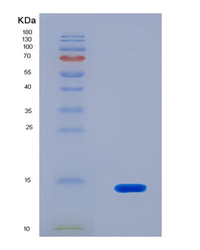 SDS-PAGE analysis of Human PIGR (Polymeric Immunoglobulin Receptor) - Recombinant Protein, CAT# BLT-08487P showing >90% purity under 15% SDS-PAGE (Reduced)Human PIGR (Polymeric Immunoglobulin Receptor) - Recombinant Protein
