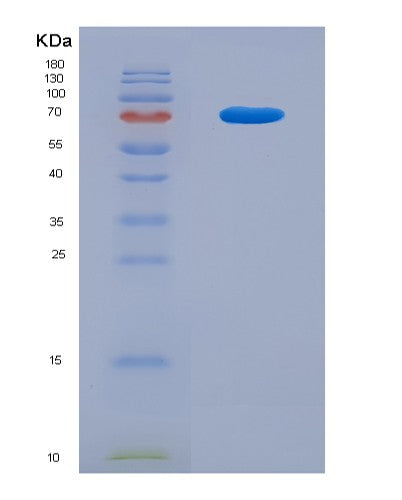 SDS-PAGE analysis of Human HSPA9 (Stress-70 Protein, Mitochondrial) - Recombinant Protein, CATHuman HSPA9 (Stress-70 Protein, Mitochondrial) - Recombinant Protein