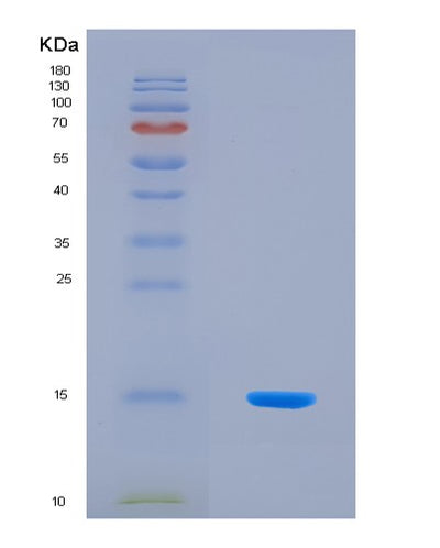 SDS-PAGE analysis of Human NPY2R (Neuropeptide Y Receptor Type 2) - Recombinant Protein, CAT# BLT-08492P showing >90% purity under 15% SDS-PAGE (Reduced)Human NPY2R (Neuropeptide Y Receptor Type 2) - Recombinant Protein