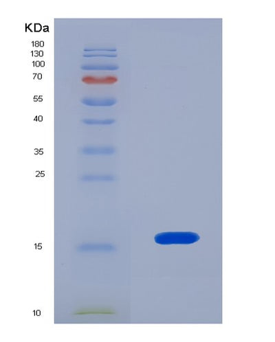SDS-PAGE analysis of Human RSPO1 (R-Spondin-1) - Recombinant Protein, CAT# BLT-08493P showing >90% purity under 15% SDS-PAGE (Reduced)Human RSPO1 (R-Spondin-1) - Recombinant Protein