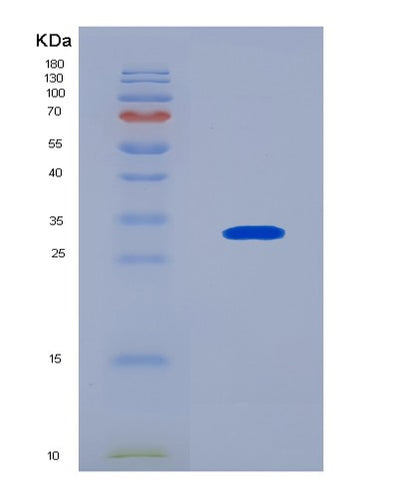 SDS-PAGE analysis of Human ABAT (4-Aminobutyrate Aminotransferase, Mitochondrial) - Recombinant Protein, CAT# BLT-08494P showing >90% purity under 15% SDS-PAGE (Reduced)Human ABAT (4-Aminobutyrate Aminotransferase, Mitochondrial) - Recombinant Protein