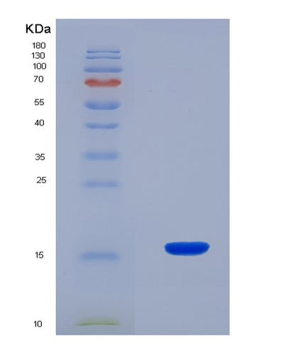 SDS-PAGE analysis of Mouse Rspo1 (R-Spondin-1) - Recombinant Protein, CAT# BLT-08495P showing >90% purity under 15% SDS-PAGE (Reduced)Mouse Rspo1 (R-Spondin-1) - Recombinant Protein