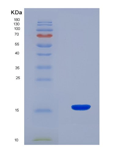 SDS-PAGE analysis of Mouse Rspo1 (R-Spondin-1) - Recombinant Protein, CATMouse Rspo1 (R-Spondin-1) - Recombinant Protein