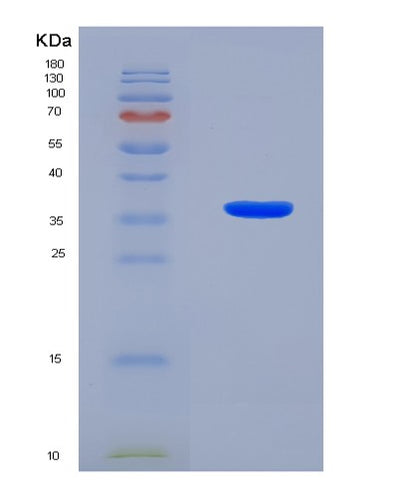 SDS-PAGE analysis of Human KRT18 (Keratin, Type I Cytoskeletal 18) - Recombinant Protein, CAT# BLT-08496P showing >90% purity under 15% SDS-PAGE (Reduced)Human KRT18 (Keratin, Type I Cytoskeletal 18) - Recombinant Protein