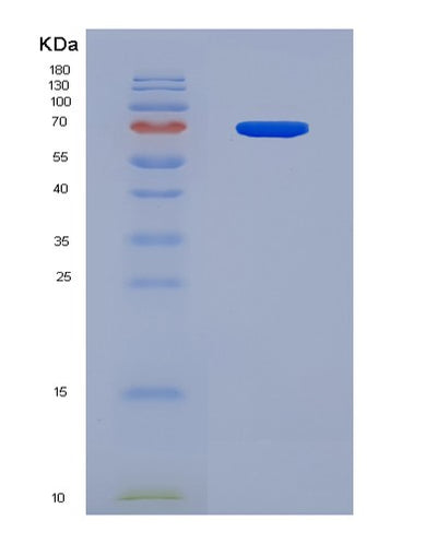 SDS-PAGE analysis of Human BDKRB2 (B2 Bradykinin Receptor) - Recombinant Protein, CAT# BLT-08497P showing >90% purity under 15% SDS-PAGE (Reduced)Human BDKRB2 (B2 Bradykinin Receptor) - Recombinant Protein