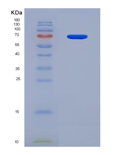 SDS-PAGE analysis of Human BDKRB2 (B2 Bradykinin Receptor) - Recombinant Protein, CATHuman BDKRB2 (B2 Bradykinin Receptor) - Recombinant Protein