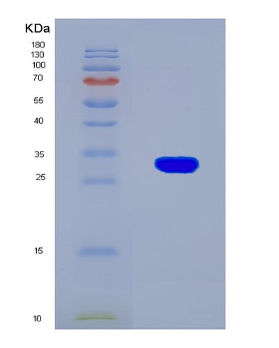 SDS-PAGE analysis of Mouse Hif1a (Hypoxia-Inducible Factor 1-Alpha) - Recombinant Protein, CAT# BLT-08500P showing >90% purity under 15% SDS-PAGE (Reduced)Mouse Hif1a (Hypoxia-Inducible Factor 1-Alpha) - Recombinant Protein