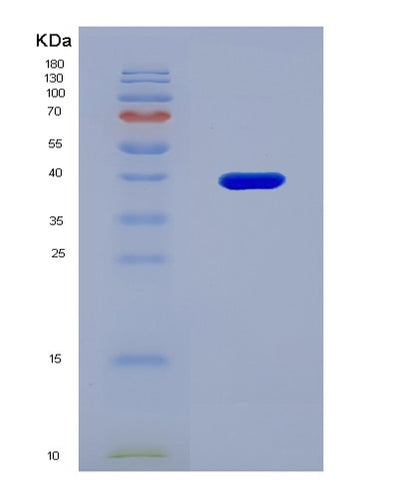 SDS-PAGE analysis of Mouse Il22ra1 (Interleukin-22 Receptor Subunit Alpha-1) - Recombinant Protein, CAT# BLT-08504P showing >90% purity under 15% SDS-PAGE (Reduced)Mouse Il22ra1 (Interleukin-22 Receptor Subunit Alpha-1) - Recombinant Protein