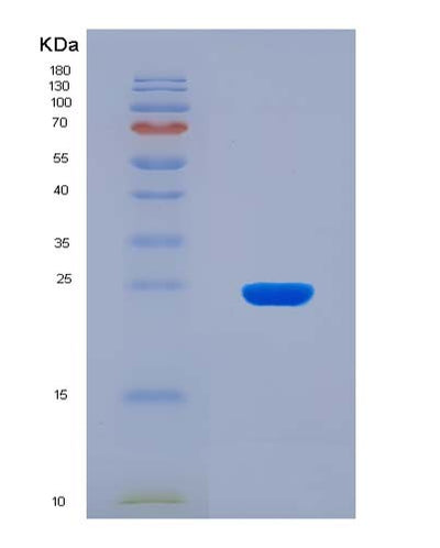 SDS-PAGE analysis of Human ITGAV (Integrin Alpha-V) - Recombinant Protein, CAT# BLT-08505P showing >90% purity under 15% SDS-PAGE (Reduced)Human ITGAV (Integrin Alpha-V) - Recombinant Protein