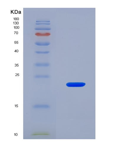 SDS-PAGE analysis of Mouse Lama4 (Laminin Subunit Alpha-4) - Recombinant Protein, CAT# BLT-08506P showing >90% purity under 15% SDS-PAGE (Reduced)Mouse Lama4 (Laminin Subunit Alpha-4) - Recombinant Protein