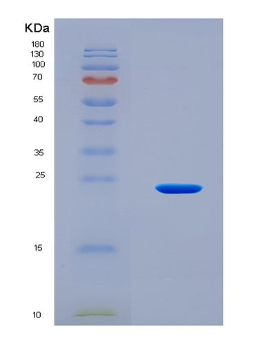 SDS-PAGE analysis of Mouse Mmp1a (Interstitial Collagenase A) - Recombinant Protein, CAT# BLT-08507P showing >90% purity under 15% SDS-PAGE (Reduced)Mouse Mmp1a (Interstitial Collagenase A) - Recombinant Protein