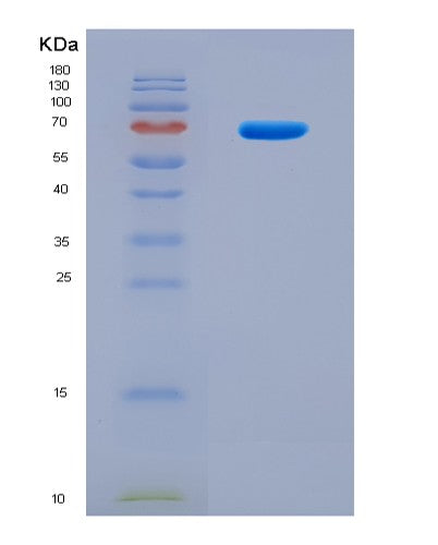 SDS-PAGE analysis of Human OPTN (Optineurin) - Recombinant Protein, CATHuman OPTN (Optineurin) - Recombinant Protein