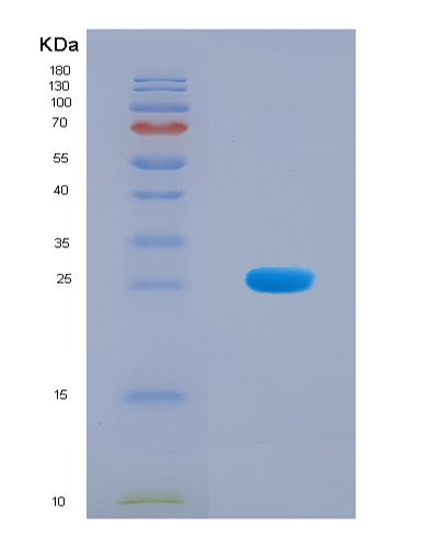 SDS-PAGE analysis of Mouse Tslp (Thymic Stromal Lymphopoietin) - Recombinant Protein, CATMouse Tslp (Thymic Stromal Lymphopoietin) - Recombinant Protein