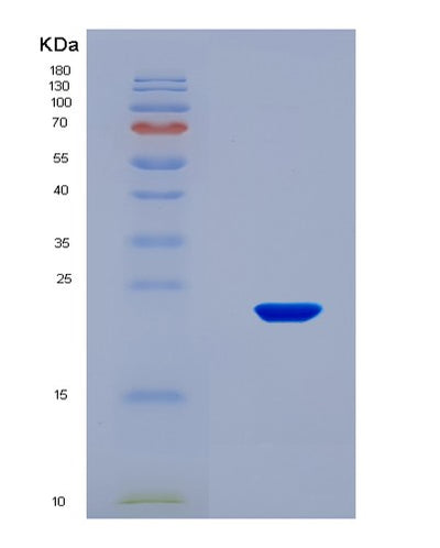 SDS-PAGE analysis of Human CSF3 (Granulocyte Colony-Stimulating Factor) - Recombinant Protein, CAT# BLT-08515P showing >90% purity under 15% SDS-PAGE (Reduced)Human CSF3 (Granulocyte Colony-Stimulating Factor) - Recombinant Protein