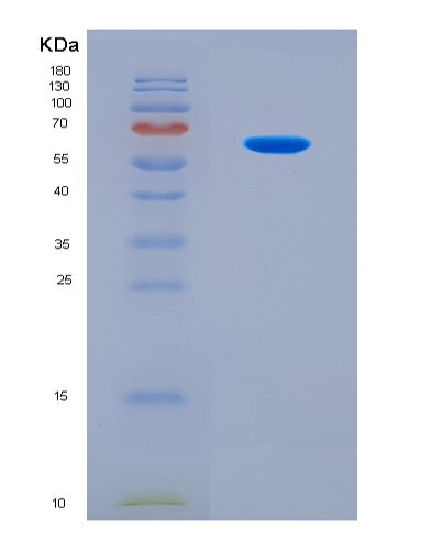 SDS-PAGE analysis of Human MMP14 (Matrix Metalloproteinase-14) - Recombinant Protein, CATHuman MMP14 (Matrix Metalloproteinase-14) - Recombinant Protein