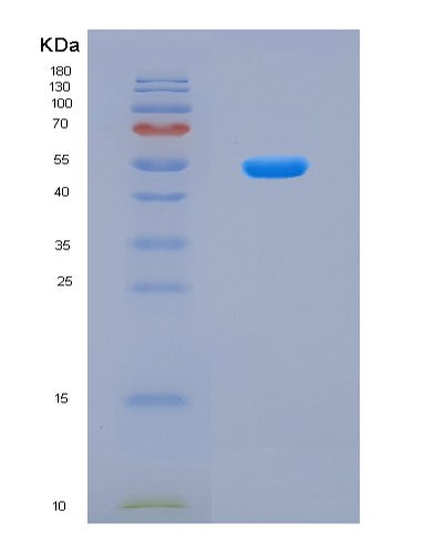 SDS-PAGE analysis of Human PTEN (Phosphatidylinositol 3,4,5-Trisphosphate 3-Phosphatase And Dual-Specificity Protein Phosphatase Pten) - Recombinant Protein, CATHuman PTEN (Phosphatidylinositol 3,4,5-Trisphosphate 3-Phosphatase And Dual-Specificity Protein Phosphatase Pten) - Recombinant Protein