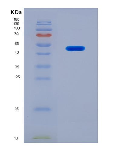 SDS-PAGE analysis of Mouse Fibroblast Growth Factor 7 (FGF7) - Recombinant Protein, CAT# BLT-08521P showing >90% purity under 15% SDS-PAGE (Reduced)Mouse Fibroblast Growth Factor 7 (FGF7) - Recombinant Protein