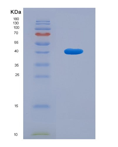 SDS-PAGE analysis of Mouse Bdnf (Neurotrophic Factor Bdnf Precursor Form) - Recombinant Protein, CATMouse Bdnf (Neurotrophic Factor Bdnf Precursor Form) - Recombinant Protein