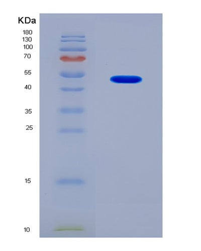 SDS-PAGE analysis of Mouse Krt18 (Keratin, Type I Cytoskeletal 18) - Recombinant Protein, CAT# BLT-08523P showing >90% purity under 15% SDS-PAGE (Reduced)Mouse Krt18 (Keratin, Type I Cytoskeletal 18) - Recombinant Protein