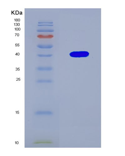 SDS-PAGE analysis of Human BMP2 (Bone Morphogenetic Protein 2) - Recombinant Protein, CAT# BLT-08527P showing >90% purity under 15% SDS-PAGE (Reduced)Human BMP2 (Bone Morphogenetic Protein 2) - Recombinant Protein