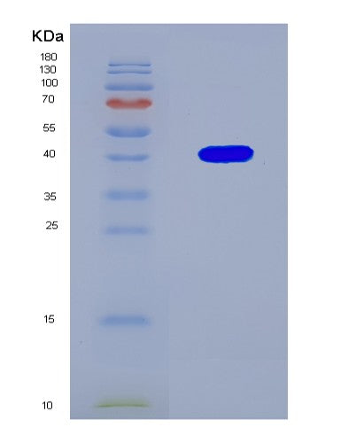 SDS-PAGE analysis of Human BMP2 (Bone Morphogenetic Protein 2) - Recombinant Protein, CATHuman BMP2 (Bone Morphogenetic Protein 2) - Recombinant Protein