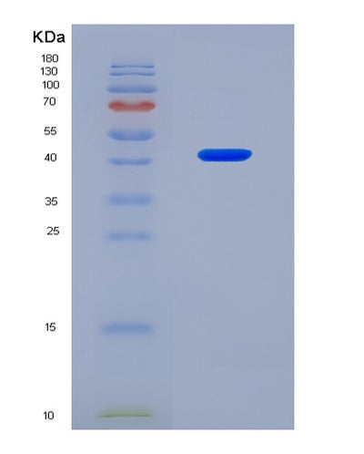 SDS-PAGE analysis of Human TFPT (Tcf3 Fusion Partner) - Recombinant Protein, CAT# BLT-08528P showing >90% purity under 15% SDS-PAGE (Reduced)Human TFPT (Tcf3 Fusion Partner) - Recombinant Protein