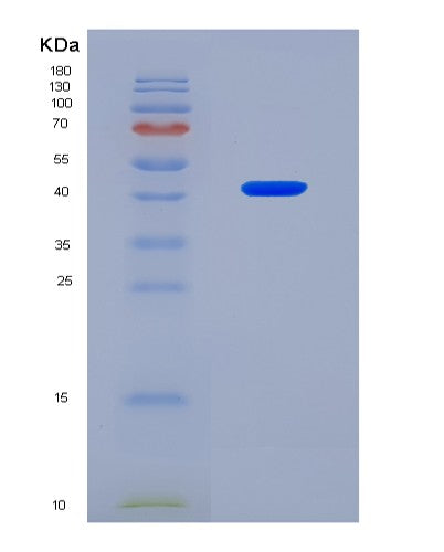 SDS-PAGE analysis of Human TFPT (Tcf3 Fusion Partner) - Recombinant Protein, CATHuman TFPT (Tcf3 Fusion Partner) - Recombinant Protein