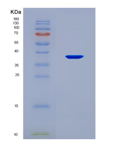 SDS-PAGE analysis of Human IL22RA1 (Interleukin-22 Receptor Subunit Alpha-1) - Recombinant Protein, CAT# BLT-08533P showing >90% purity under 15% SDS-PAGE (Reduced)Human IL22RA1 (Interleukin-22 Receptor Subunit Alpha-1) - Recombinant Protein