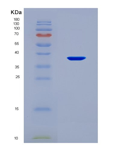 SDS-PAGE analysis of Human IL22RA1 (Interleukin-22 Receptor Subunit Alpha-1) - Recombinant Protein, CATHuman IL22RA1 (Interleukin-22 Receptor Subunit Alpha-1) - Recombinant Protein