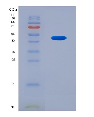 SDS-PAGE analysis of Human COL5A2 (Collagen Alpha-2(V) Chain) - Recombinant Protein, CATHuman COL5A2 (Collagen Alpha-2(V) Chain) - Recombinant Protein