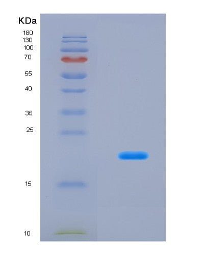 SDS-PAGE analysis of Mouse Rps19 (Small Ribosomal Subunit Protein Es19) - Recombinant Protein, CATMouse Rps19 (Small Ribosomal Subunit Protein Es19) - Recombinant Protein