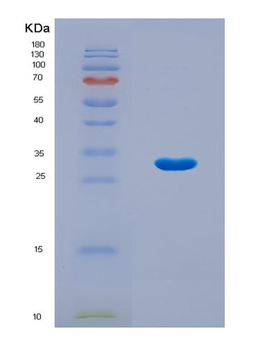 SDS-PAGE analysis of Human CAPN1 (Calpain-1 Catalytic Subunit) - Recombinant Protein, CAT# BLT-08539P showing >90% purity under 15% SDS-PAGE (Reduced)Human CAPN1 (Calpain-1 Catalytic Subunit) - Recombinant Protein