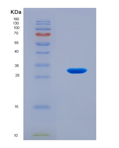 SDS-PAGE analysis of Human PRSS1 (Serine Protease 1) - Recombinant Protein, CATHuman PRSS1 (Serine Protease 1) - Recombinant Protein