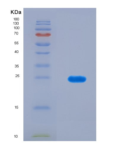 SDS-PAGE analysis of Human RERGL (Ras-Related And Estrogen-Regulated Growth Inhibitor-Like Protein) - Recombinant Protein, CATHuman RERGL (Ras-Related And Estrogen-Regulated Growth Inhibitor-Like Protein) - Recombinant Protein