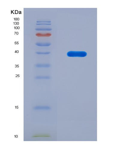 SDS-PAGE analysis of Human PDIK1L (Serine/Threonine-Protein Kinase Pdik1L) - Recombinant Protein, CAT# BLT-08549P showing >90% purity under 15% SDS-PAGE (Reduced)Human PDIK1L (Serine/Threonine-Protein Kinase Pdik1L) - Recombinant Protein